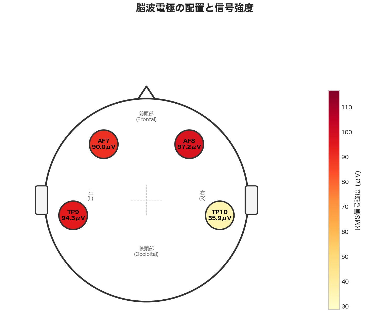 脳波電極の配置